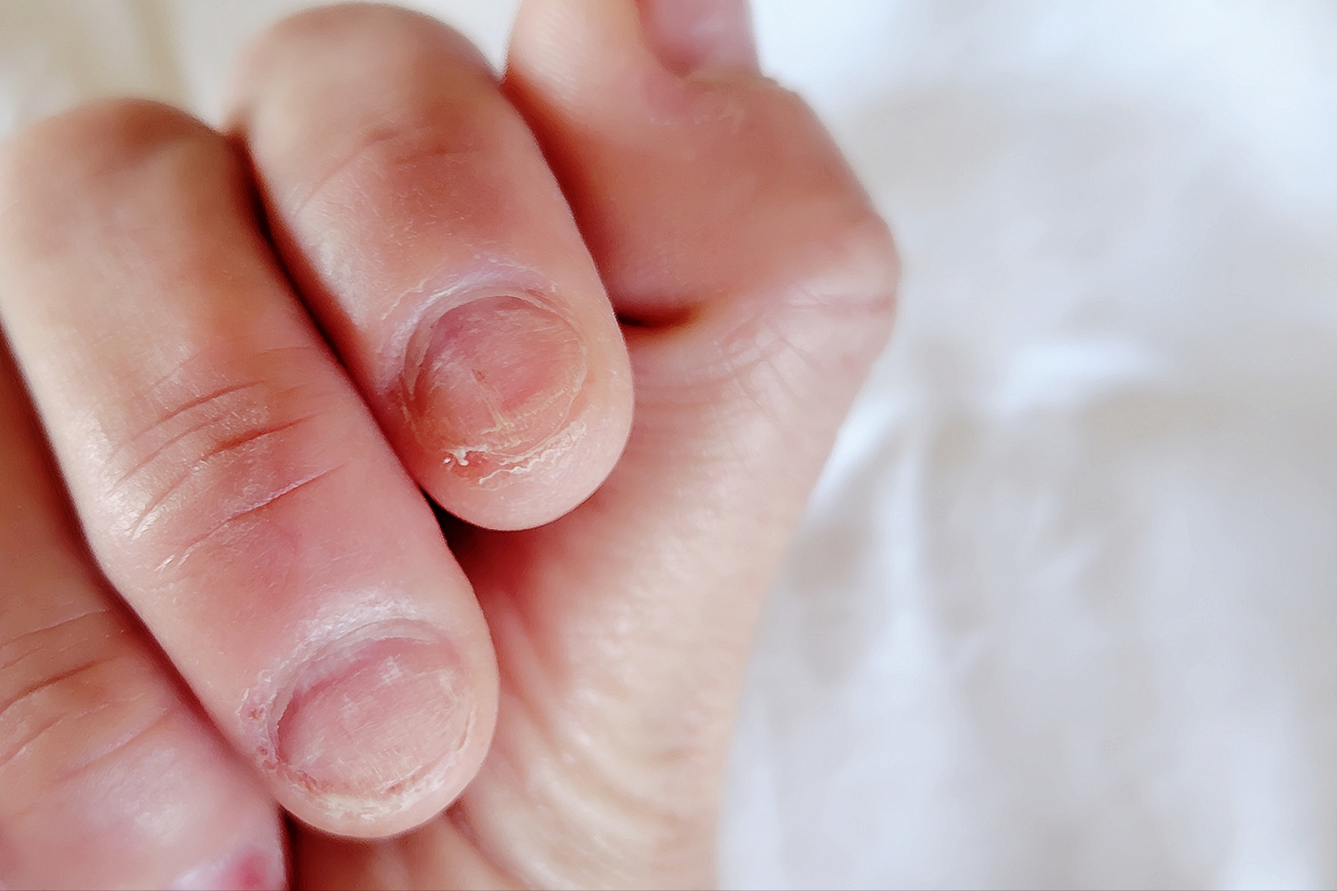 深爪をしている指先
